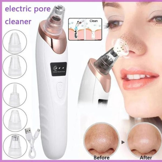 White & black head Remover