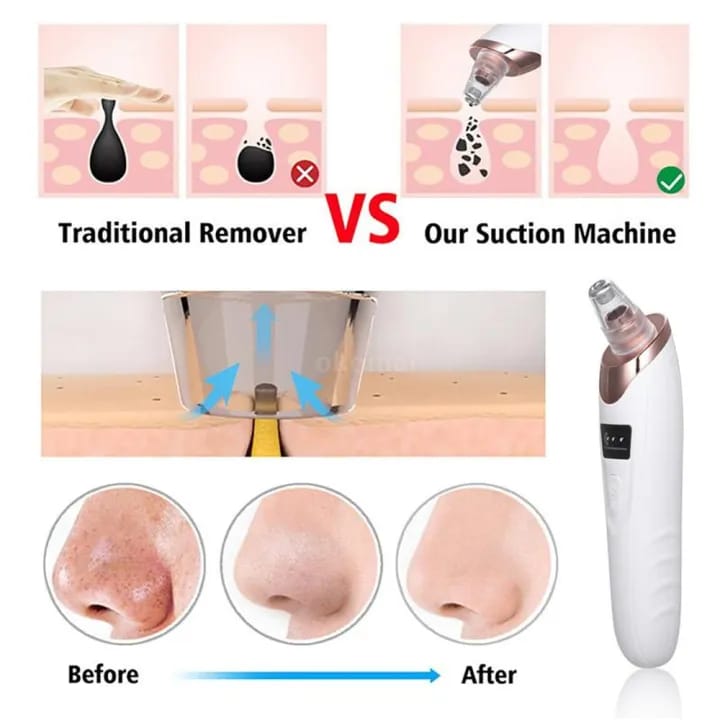 White & black head Remover